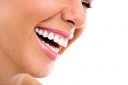 Фотополимерна пломба + преглед на зъбите и план за лечение със 74% отстъпка