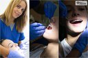 Поставяне на метални брекети на една челюст или две челюсти + Безплатни прегледи до края на лечението, в Стоматологичен кабинет Д-р Лозеви