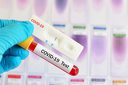 Бърз антиген тест за COVID-19 на добра цена, от СМДЛ Кандиларов