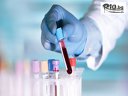 Кръвен тест за непоносимост към 44 храни + изследване за Candida Albicans IgG от СМДЛ Кандиларов