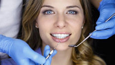 Избелване на зъби и филър на устни