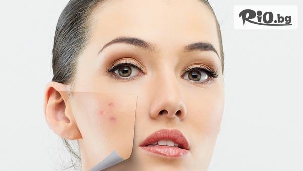Терапия за мазна кожа, предразположенa към акне + масаж на лице, от Alga Beauty & Spa
