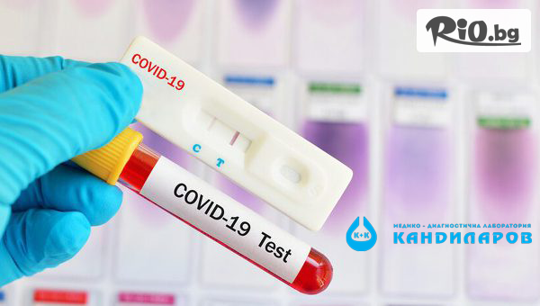 Бърз антиген тест за наличие на COVID-19, предоставен от СМДЛ Кандиларов