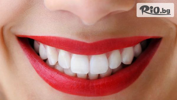 За блестяща усмивка! Професионално избелване на зъби с LED лампа-робот и италианска избелваща система за зъби BMS white 38% HP гел, от Стоматологичен кабинет Д-р Лозеви