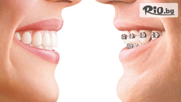 Био Дент - thumb 2