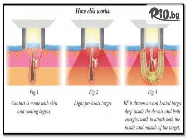 Студио Sunny Life - thumb 6