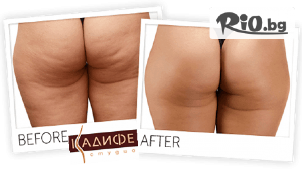 Спа студио Кадифе - thumb 3