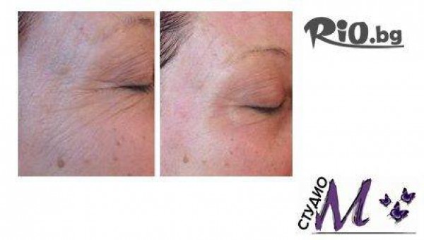 Студио М - thumb 4