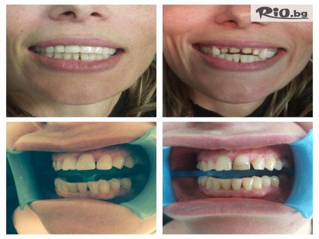 Дентална клиника СитиДент - thumb 3 Дентална клиника СитиДент - thumb 3