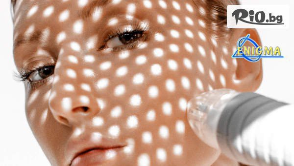 Центрове Енигма - thumb 2