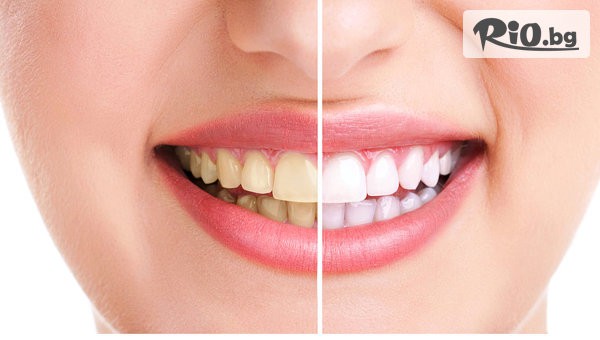 Дентална клиника Персенк - thumb 1