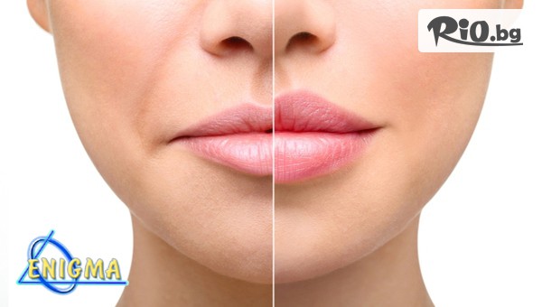 Центрове Енигма - thumb 2