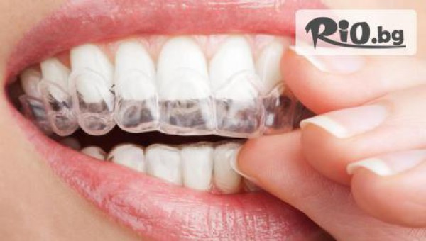 Дентален преглед, почистване на зъбен камък с ултразвук + изработване на индивидуални шини за домашно избелване + гелчета за избелване с 50% отстъпка за 139.90лв, от Ватус Дент