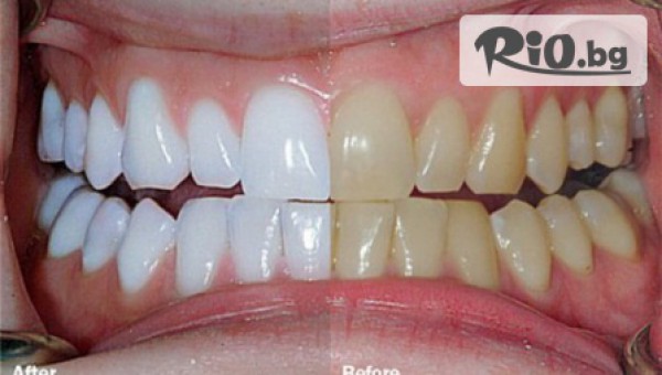 Ватус Дент - thumb 2