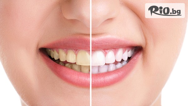 Стоматолози д-р Лозеви - thumb 2