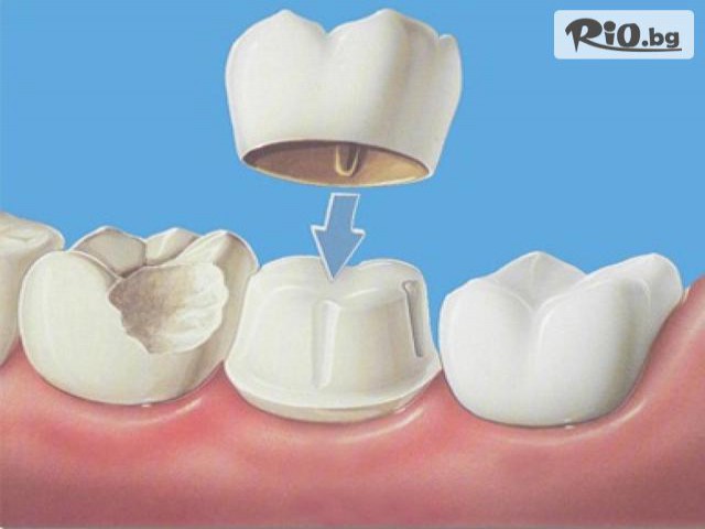 Дентална клиника д-р В. Георгиев - thumb 4 Дентална клиника д-р В. Георгиев - thumb 4