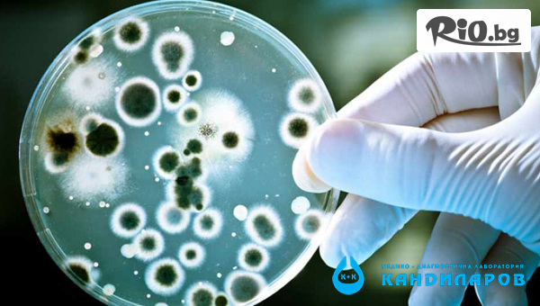 Кръвен тест за непоносимост към 44 храни + изследване за Candida Albicans IgG от СМДЛ Кандиларов