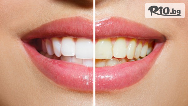 ПримаДент - thumb 3