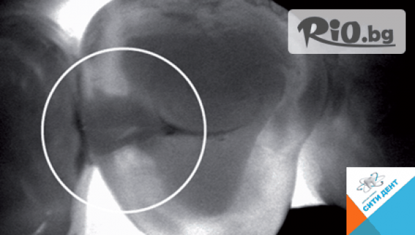 Дентална клиника СитиДент - thumb 4