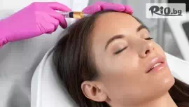 Микроиглена мезотерапия за коса #1