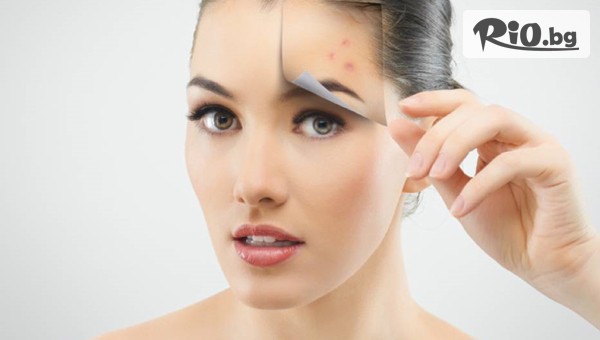 Alma Morel - thumb 2