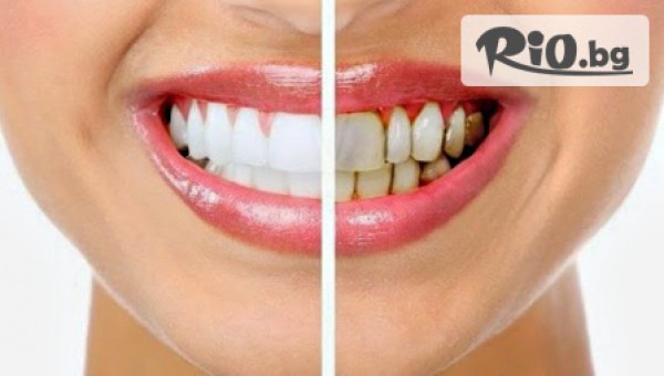 ПАКТ ДЕНТАЛ - thumb 3