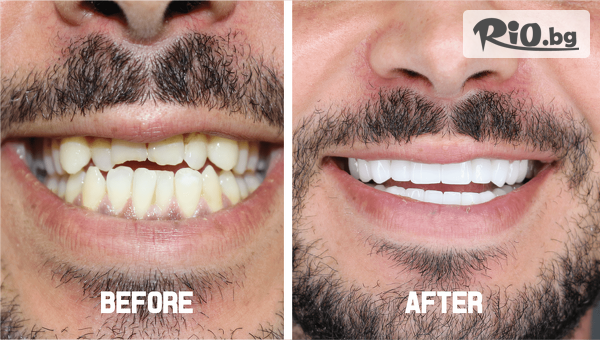 Eвровита Дентал - thumb 2