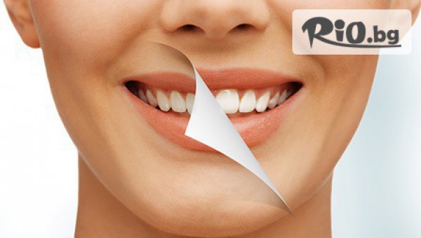 Снежнобяла усмивка! Преглед + Професионално избелване на зъби със системата Easy Whitening USA - за 130лв, от Дентална клиника Артдентал