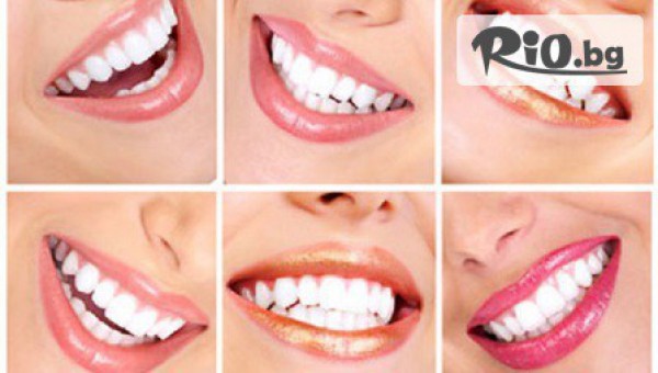 За да се усмихвате със самочувствие! Избелване на зъби със 100% натурален гел само за 38лв, от Magic White