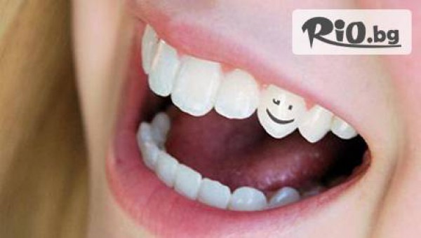 Д-р. Даниела Николова - стоматолог - thumb 3