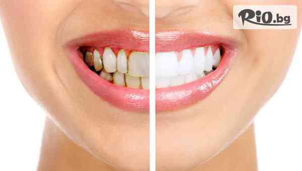 Дентална клиника СитиДент - thumb 2