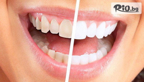 Eвровита Дентал - thumb 2