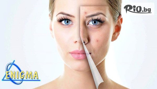 Центрове Енигма - thumb 2